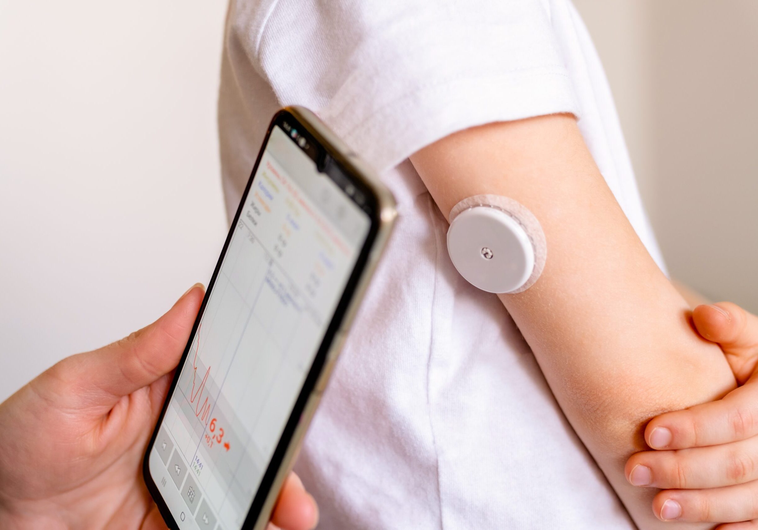 Cgm,-system,Of,Continuous,Monitoring,Of,Glucose,On,Child's,Arm.